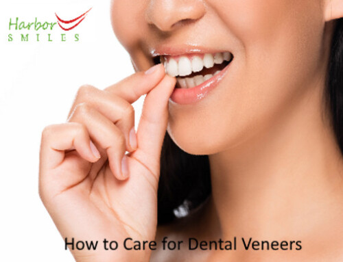 How To Care For Dental Veneers?