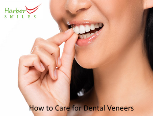How To Care For Teeth Veneers